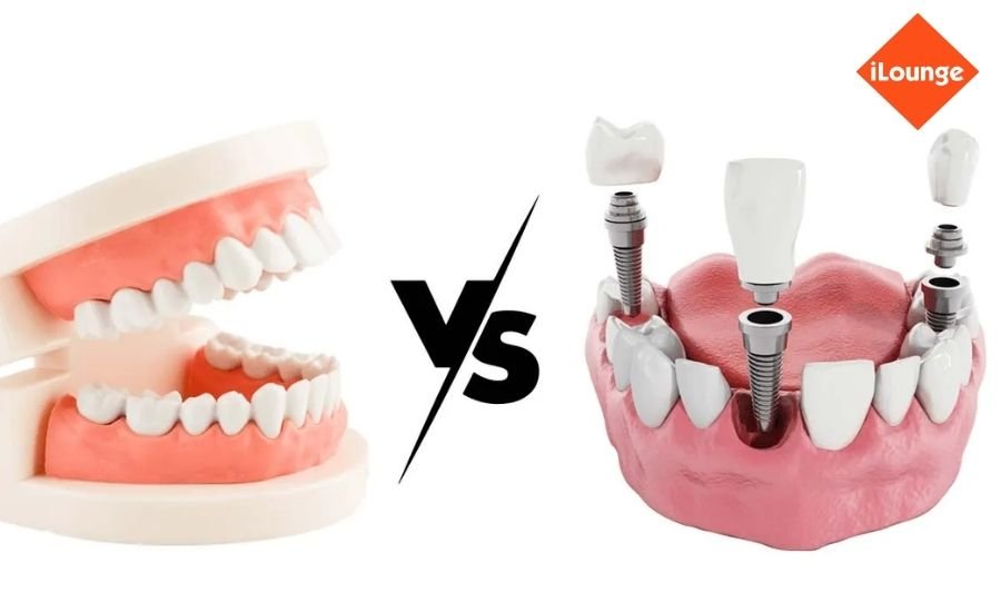 Dental Implants Vs. Partial Dentures